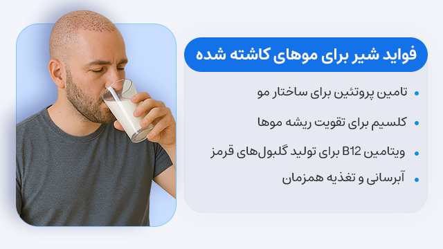 مصرف شیر و لبنیات بعد از کاشت مو