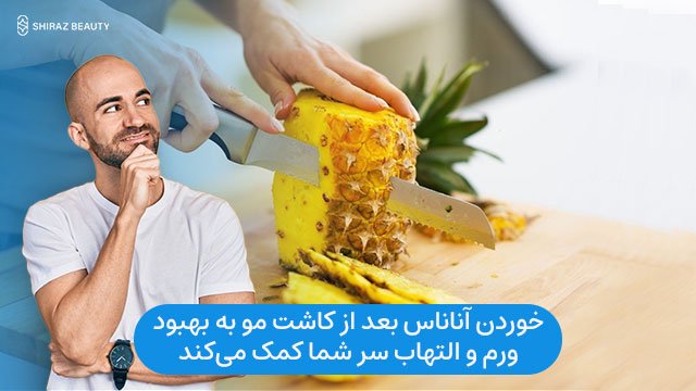 خوردن آناناس بعد از کاشت مو به بهبود ورم و التهاب سر شما کمک می‌کند