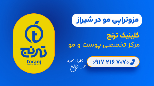 مزوتراپی مو در شیراز - کلینیک ترنج