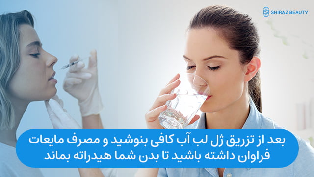 بعد از تزریق ژل لب آب کافی بنوشید و مصرف مایعات فراوان داشته باشید