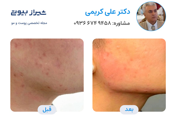 زاویه سازی صورت در شیراز - دکتر علی کریمی