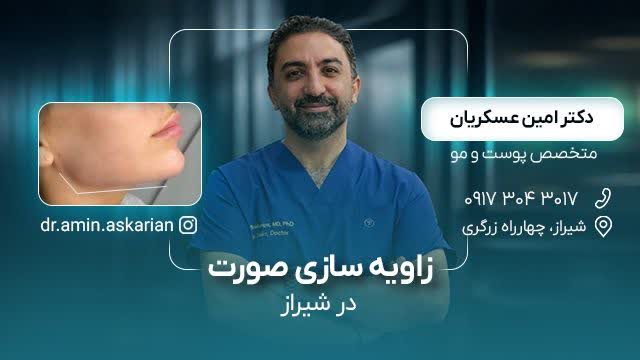 زاویه سازی صورت در شیراز - دکتر امین عسکریان