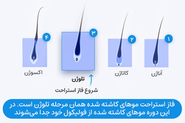 فاز استراحت موهای کاشته شده همان مرحله تلوژن است. در این مرحله موهای کاشته شده از فولیکول خود جدا می‌شوند.