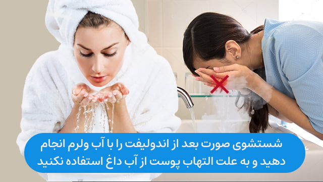شستشوی صورت بعد از اندولیفت را با آب ولرم انجام دهید و به علت التهاب پوست از آب داغ استفاده نکنید 