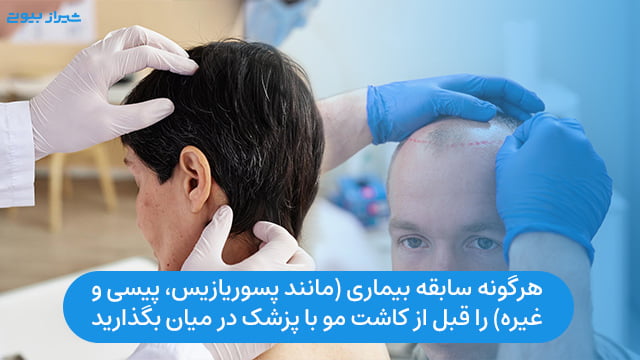 هرگونه سابقه بیماری (مانند پسوریازیس، پیسی و غیره) را قبل از کاشت مو با پزشک در میان بگذارید