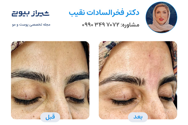 جوانسازی پوست در شیراز - دکتر فخرالسادات نقیب