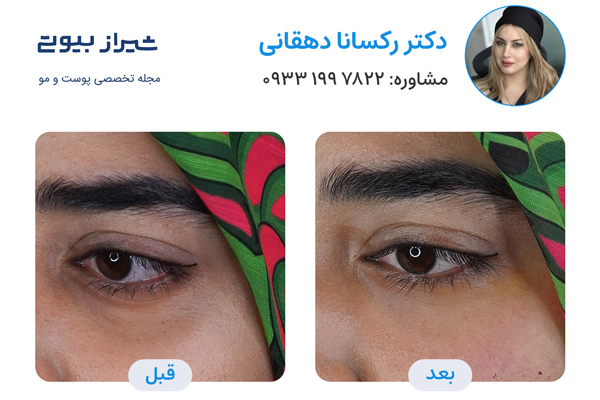 جوانسازی پوست در شیراز - دکتر رکسانا دهقانی