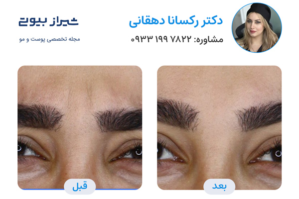 جوانسازی پوست در شیراز - دکتر رکسانا دهقانی