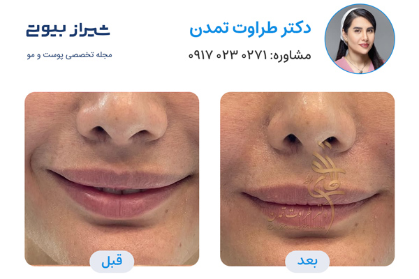 جوانسازی پوست در شیراز - دکتر طراوت تمدن