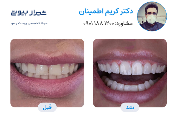 10 بهترین دکتر کامپوزیت دندان در شیراز، دکتر کریم اطمینان