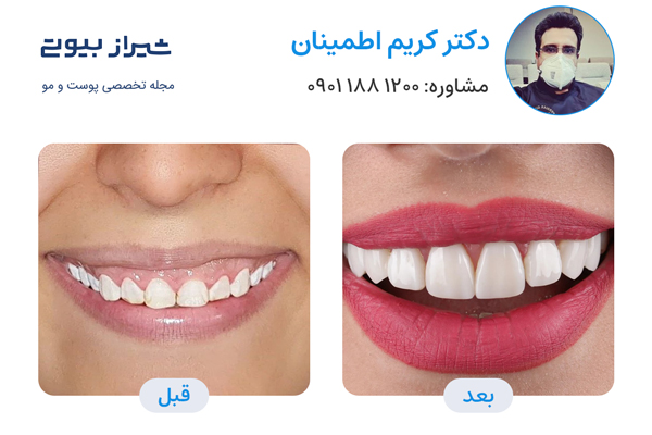 10 بهترین دکتر کامپوزیت دندان در شیراز، دکتر کریم اطمینان