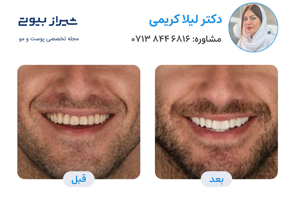 10 بهترین دکتر کامپوزیت دندان در شیراز، دکتر لیلا کریمی