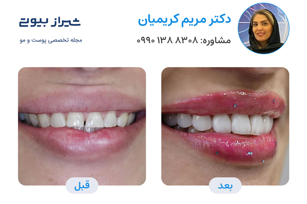 10 بهترین دکتر کامپوزیت دندان در شیراز، دکتر مریم کریمیان