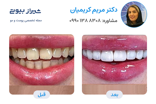 10 بهترین دکتر کامپوزیت دندان در شیراز، دکتر مریم کریمیان