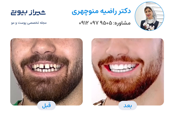 10 بهترین دکتر کامپوزیت دندان در شیراز، دکتر راضیه منوچهری