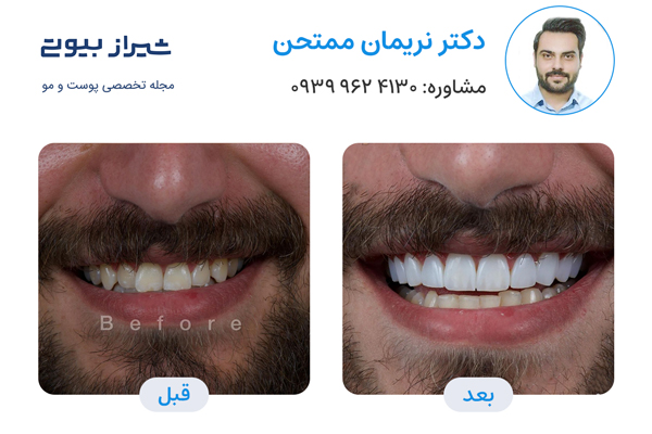 10 بهترین دکتر کامپوزیت دندان در شیراز، دکتر نریمان ممتحن
