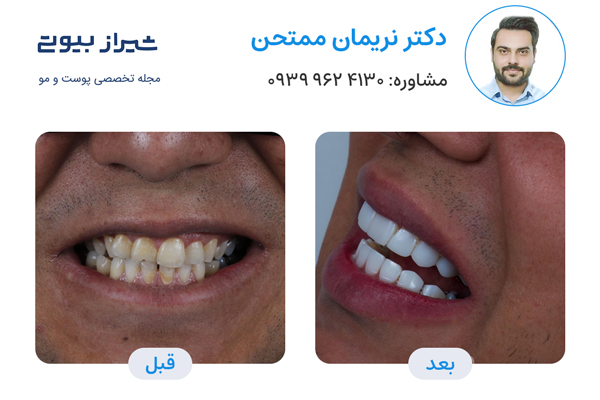 10 بهترین دکتر کامپوزیت دندان در شیراز، دکتر نریمان ممتحن
