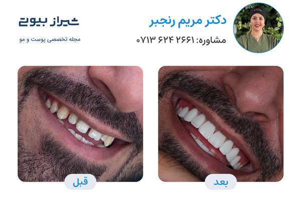 10 بهترین دکتر کامپوزیت دندان در شیراز، دکتر مریم رنجبر