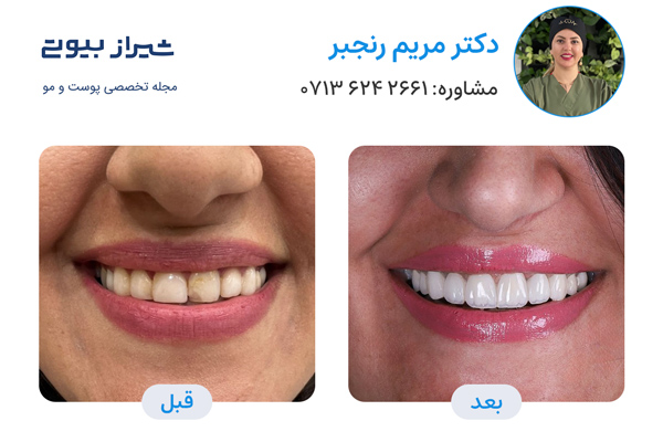 10 بهترین دکتر کامپوزیت دندان در شیراز، دکتر مریم رنجبر