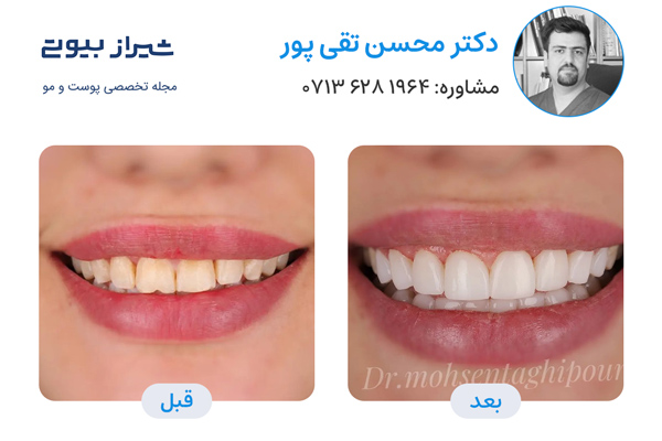 10 بهترین دکتر کامپوزیت دندان در شیراز، دکتر محسن تقی پور