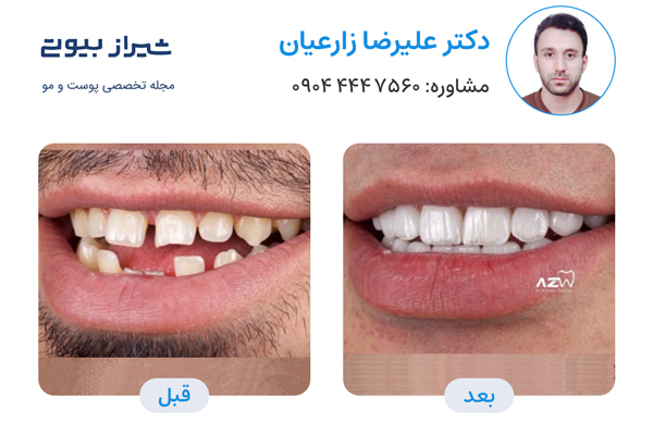 10 بهترین دکتر کامپوزیت دندان در شیراز، دکتر علیرضا زارعیان