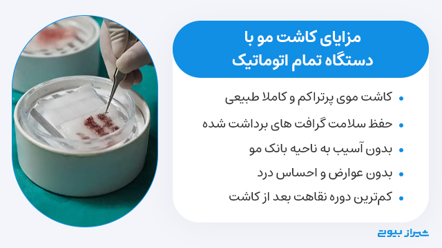 مزایای کاشت مو با دستگاه اتوماتیک