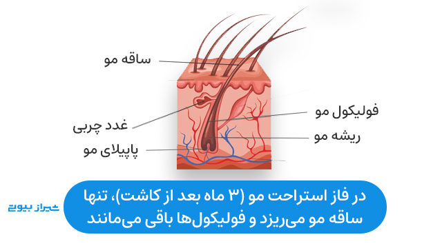 در فاز استراحت مو (3 ماه بعد از کاشت)، تنها ساقه مو می‌ریزد و فولیکول‌ها باقی می‌مانند. 
