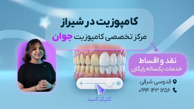 کامپوزیت دندان در شیراز - دکتر عاطفه جوان