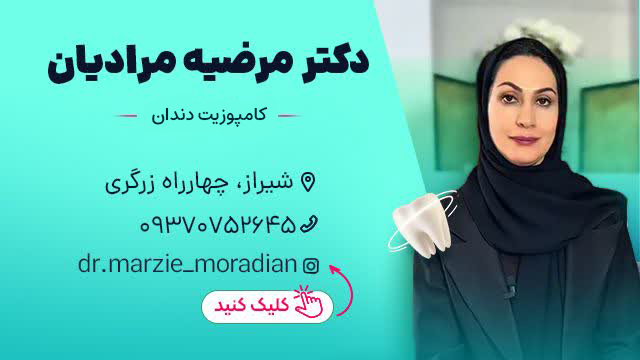 کامپوزیت دندان در شیراز - دکتر مرضیه مرادیان