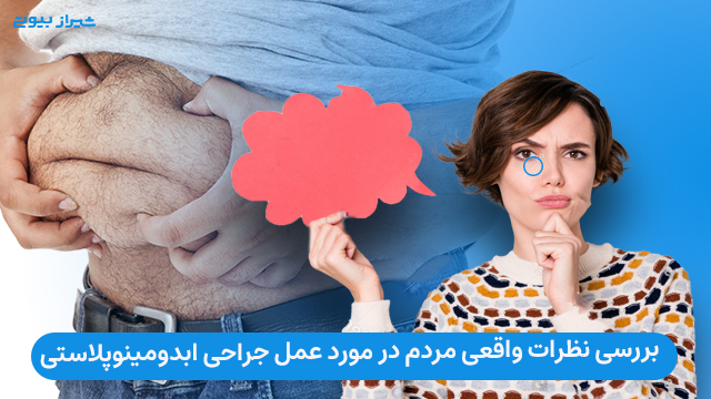 نظرات واقعی کسانی که ابدومینوپلاستی انجام داده اند