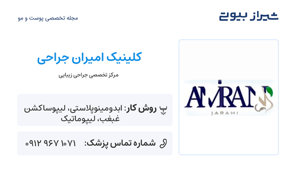 ساکشن غبغب در شیراز - کلینیک امیران جراحی