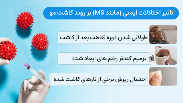 تاثیر اختلالات ایمنی (مانند MS) بر روند کاشت مو