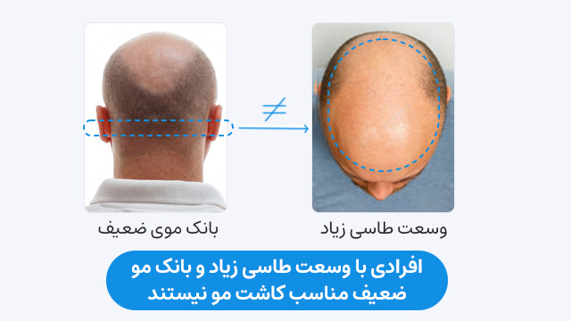 افرادی با وسعت طاسی زیاد و بانک مو ضعیف مناسب کاشت مو نیستند.