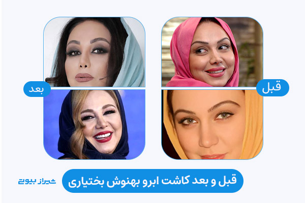 نتیجه کاشت ابرو بهنوش بختیاری
