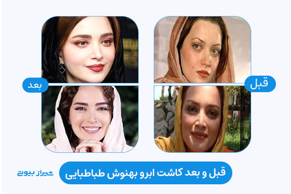 نتیجه کاشت ابرو بهنوش طباطبایی