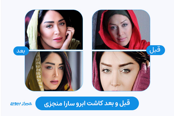 نتیجه کاشت ابرو سارا منجزی (کاشت ابرو بازیگر زن ایرانی)