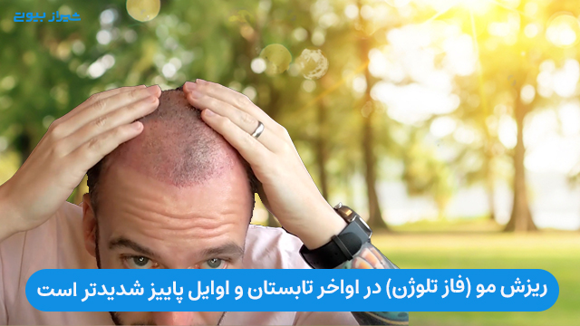  ریزش مو (فاز تلوژن) در اواخر تابستان و اوایل پاییز شدیدتر است.