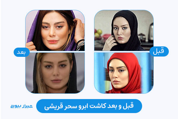 نتیجه کاشت ابروی سحر قریشی (بازیگر و هنرمند زن)