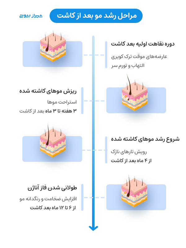 مراحل و زمان رشد مو بعد از کاشت