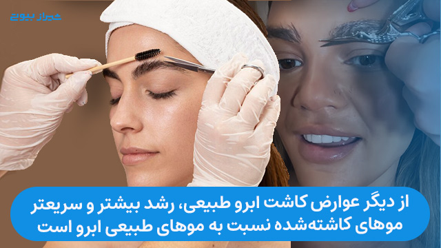 یکی از عوارض کاشت ابرو، رشد بیشتر و سریعتر موهای کاشته شده نسبت به موهای طبیعی ابرو است.