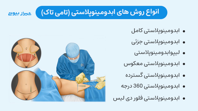 انواع روش های ابدومینوپلاستی و میزان تهاجمی بودن، مرگ و عوارض در هر یک