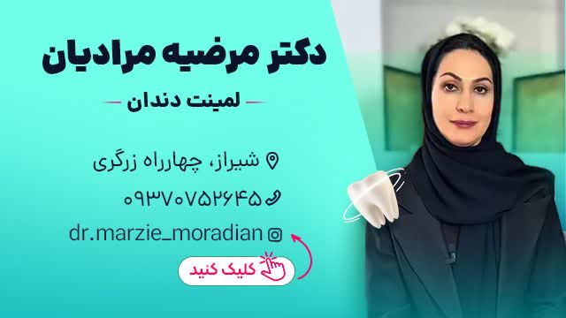 لمینت دندان در شیراز - دکتر مرضیه مرادیان
