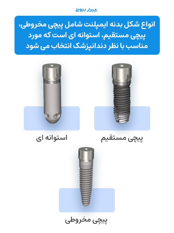 انواع ایمپلنت دندان براساس طراحی و شکل پایه  