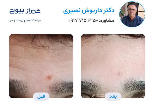 دکتر تزریق بوتاکس شیراز - دکتر داریوش نصیری