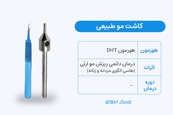 کاشت مو؛ درمان دائمی ریزش مو هورمونی ارثی