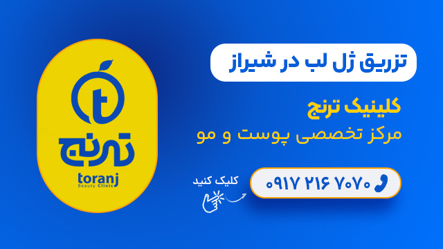 تزریق ژل لب در شیراز - کلینیک ترنج