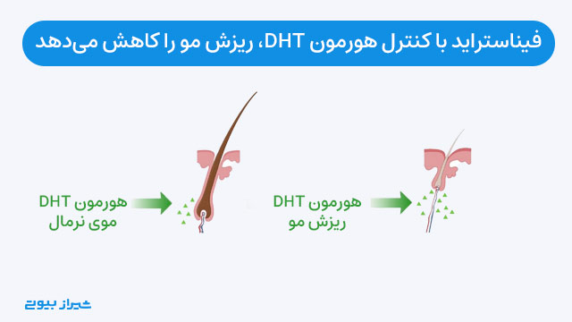 فیناستراید با کنترل هورمون DHT، ریزش مو را کاهش می‌دهد.