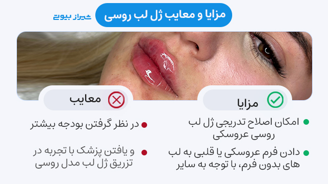 معایب ژل لب روسي