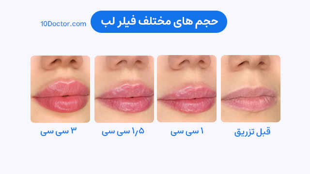 مدل لب روسی طبیعی نیم سی سی - ۱ سی سی - ۲ سی سی - ۳ سی سی