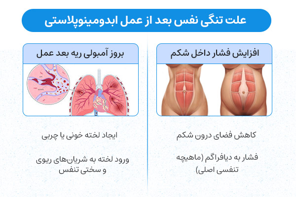 علت تنگی نفس بعد از ابدومینوپلاستی